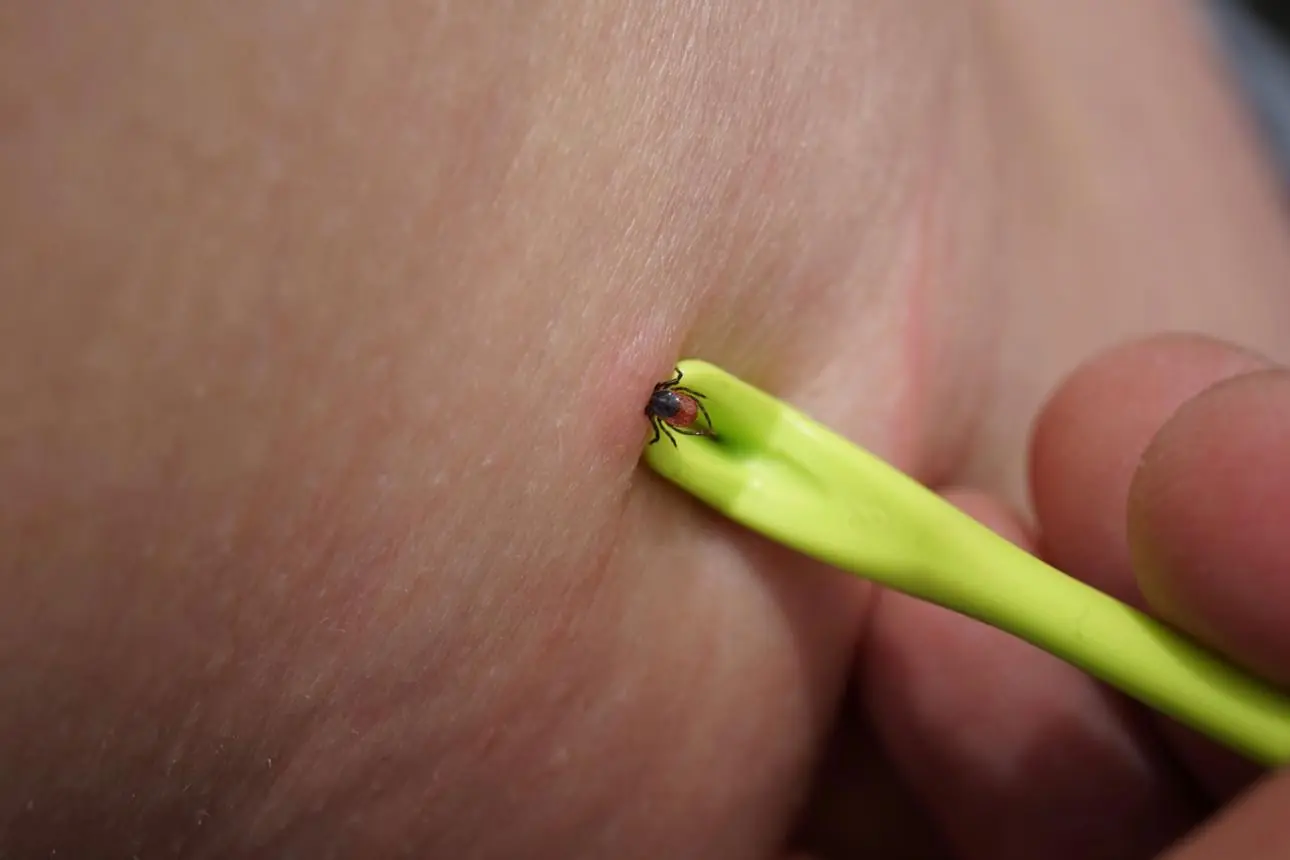 Why Experts Warn Against Flushing Ticks Down the Toilet After Removal