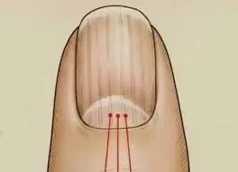 Your Nails Are Constantly Changing โ Here's What They May Be Trying to Tell You