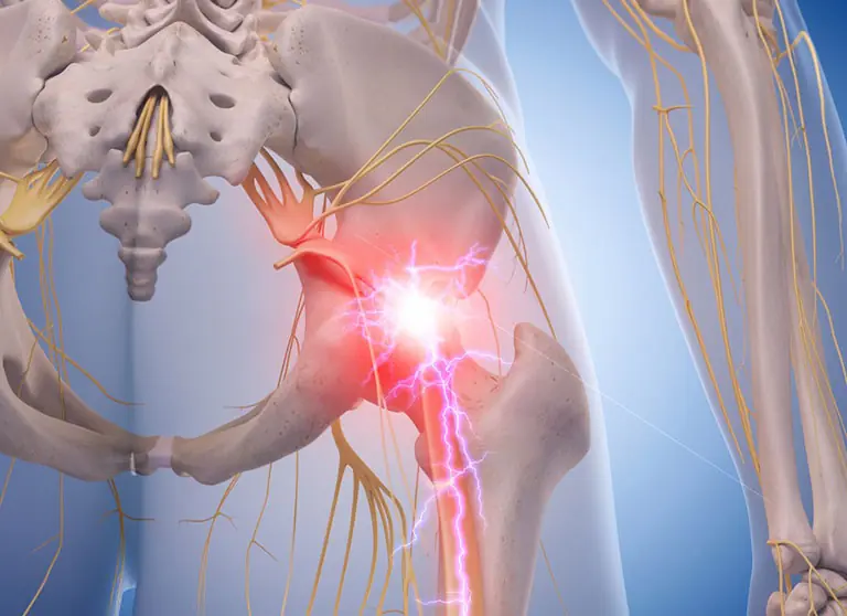 Understanding Nerve Pain in the Feet and Legs: Symptoms, Management and Treatment Approaches