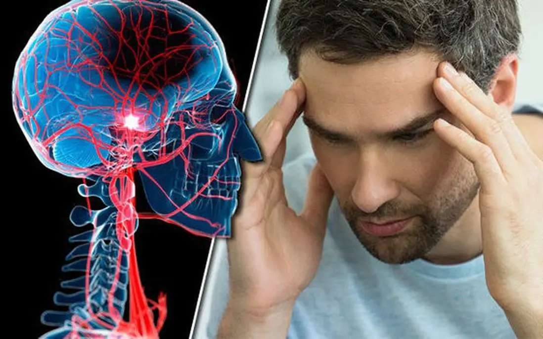 Don't Ignore These Possible Aneurysm Symptoms — They May Be Serious