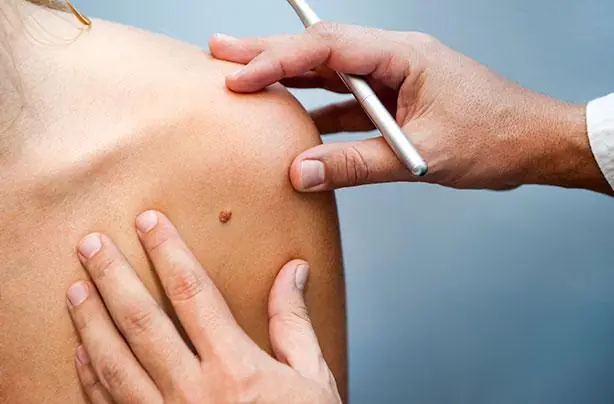 5 Warning Signs of Can.cer Developing in the Body That Should Never Be Ignored