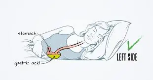 The Hidden Effects of Sleeping on Your Right Side β What You Need to Know