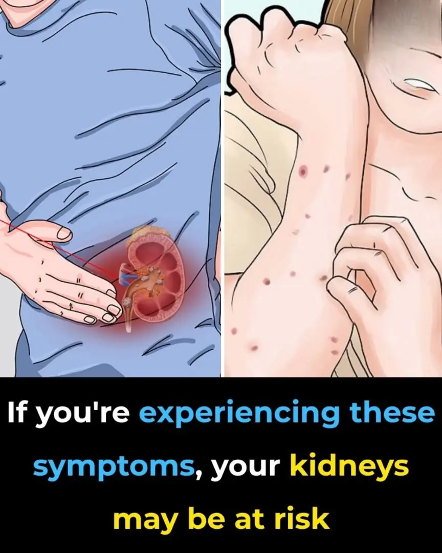 Your kidneys could be silently struggling 😨 Here are the signs to watch for and habits that may help protect them