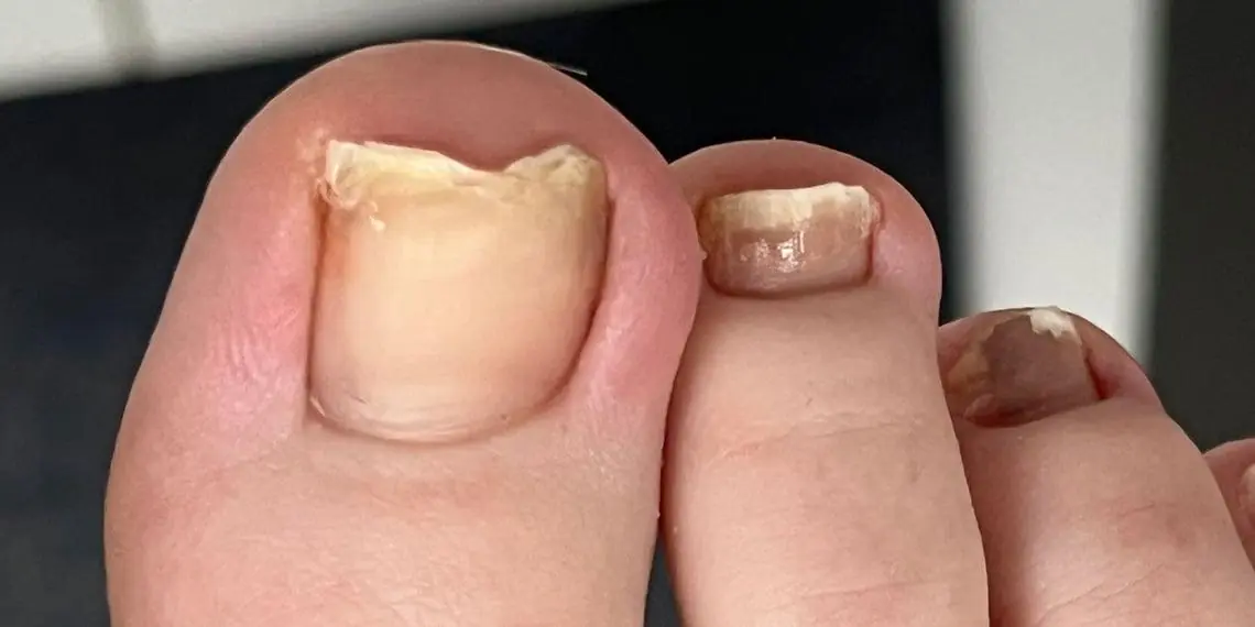 Doctors Warn: Two Foot Symptoms That May Reveal a Silent Health Problem