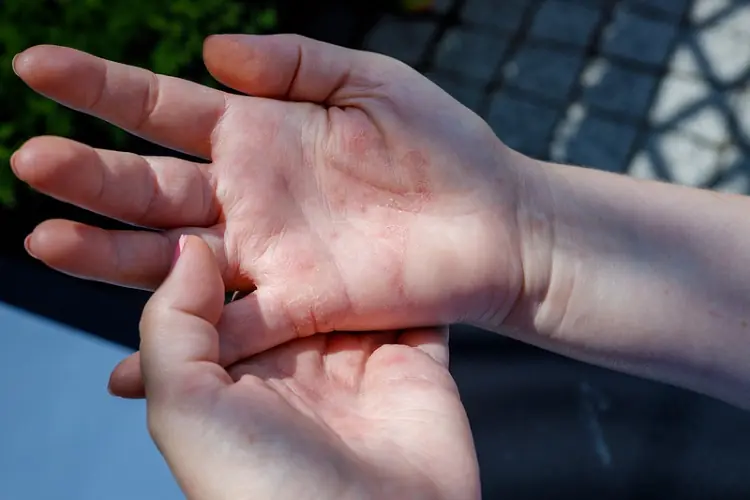 If You Don’t See These 5 Signs on Your Hands, Congratulations
