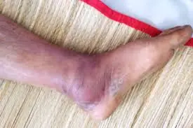Your Legs Could Reveal More About Your Health Than You Think—4 Signs to Know