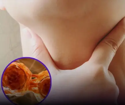 Lym.phoma survivors share six symptoms they experienced before diagnosis