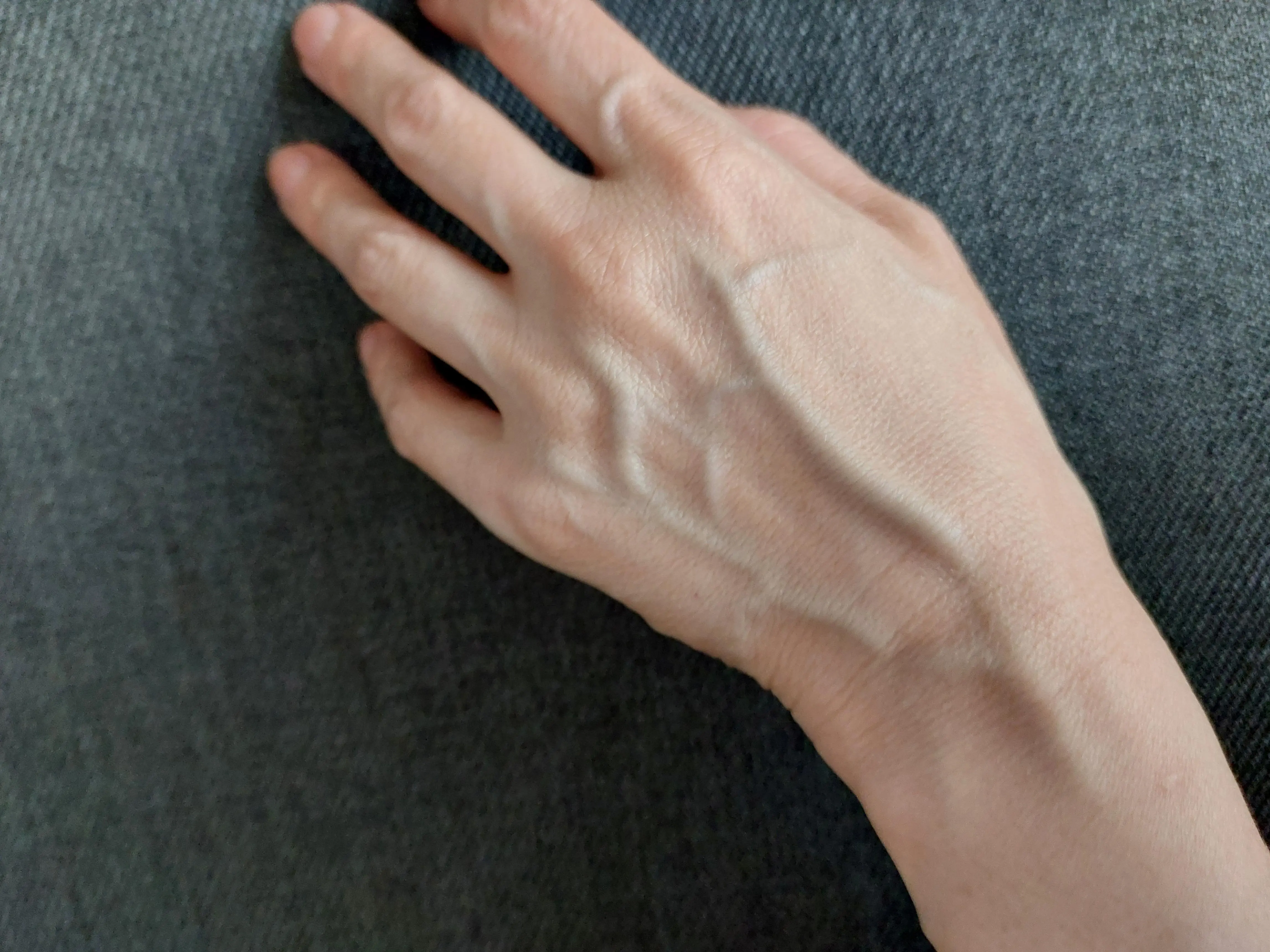 If your veins are visible, it means you are… See more
