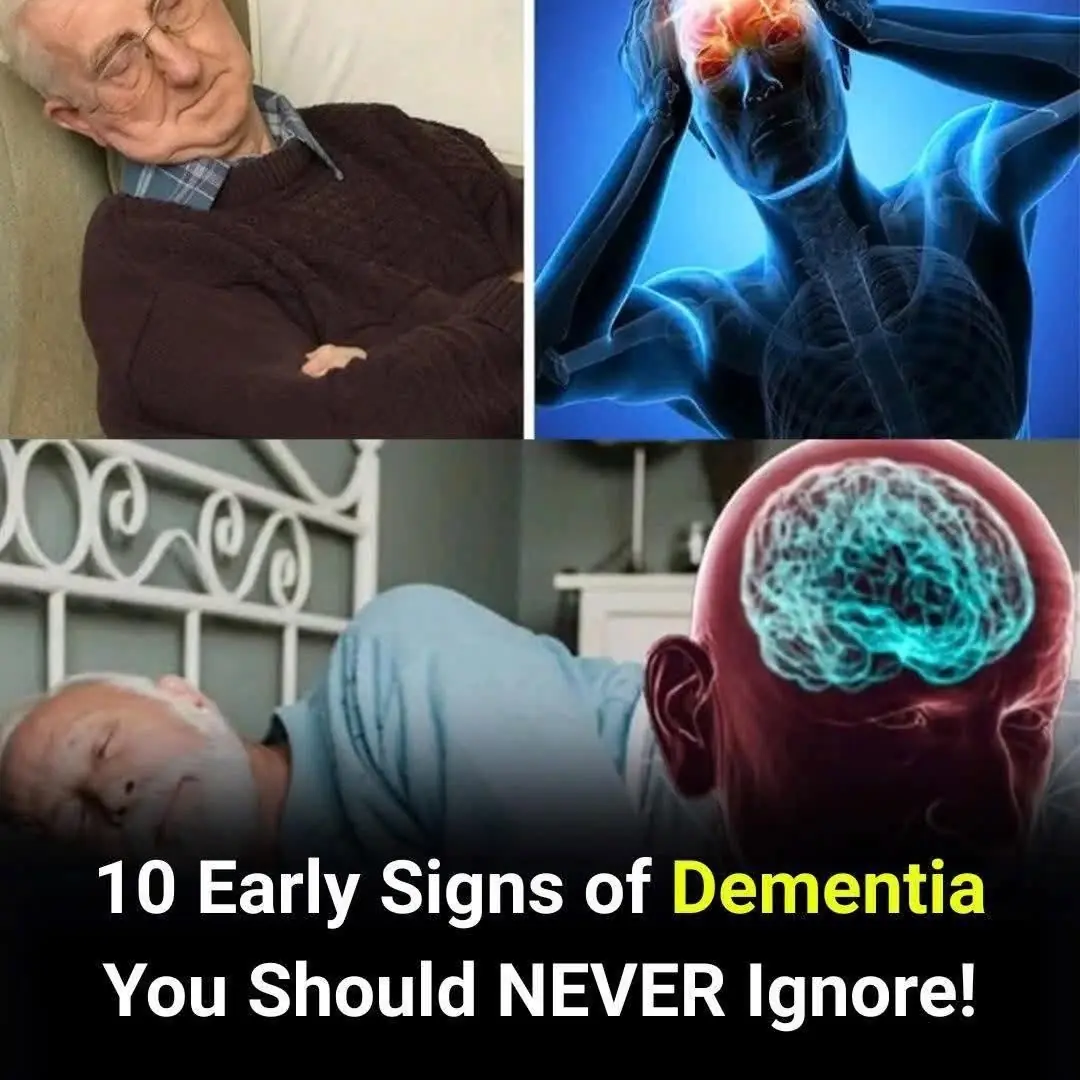 10 Early Dementia Signs Your Brain Is Warning You About