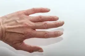 Visible Veins Aren't Always Just About Aging—Here's What Experts Want You to Know