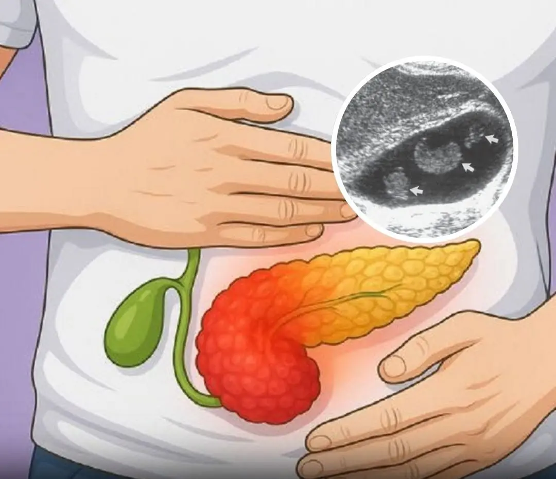 The Most Likely Symptoms of a Gallbladder Problem (Don’t Ignore Them)....