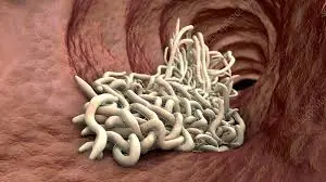When a Ch:ild's Itching Intensifies at Night, It May Be Time to Look Beyond the Surface