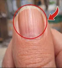 Your Nails May Be Trying to Warn You About Underlying Health Issues — Especially After 40