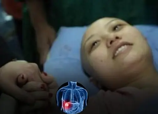A Young Life Lost to Liver Cancer: Understanding the Warning Signs Behind the Headlines
