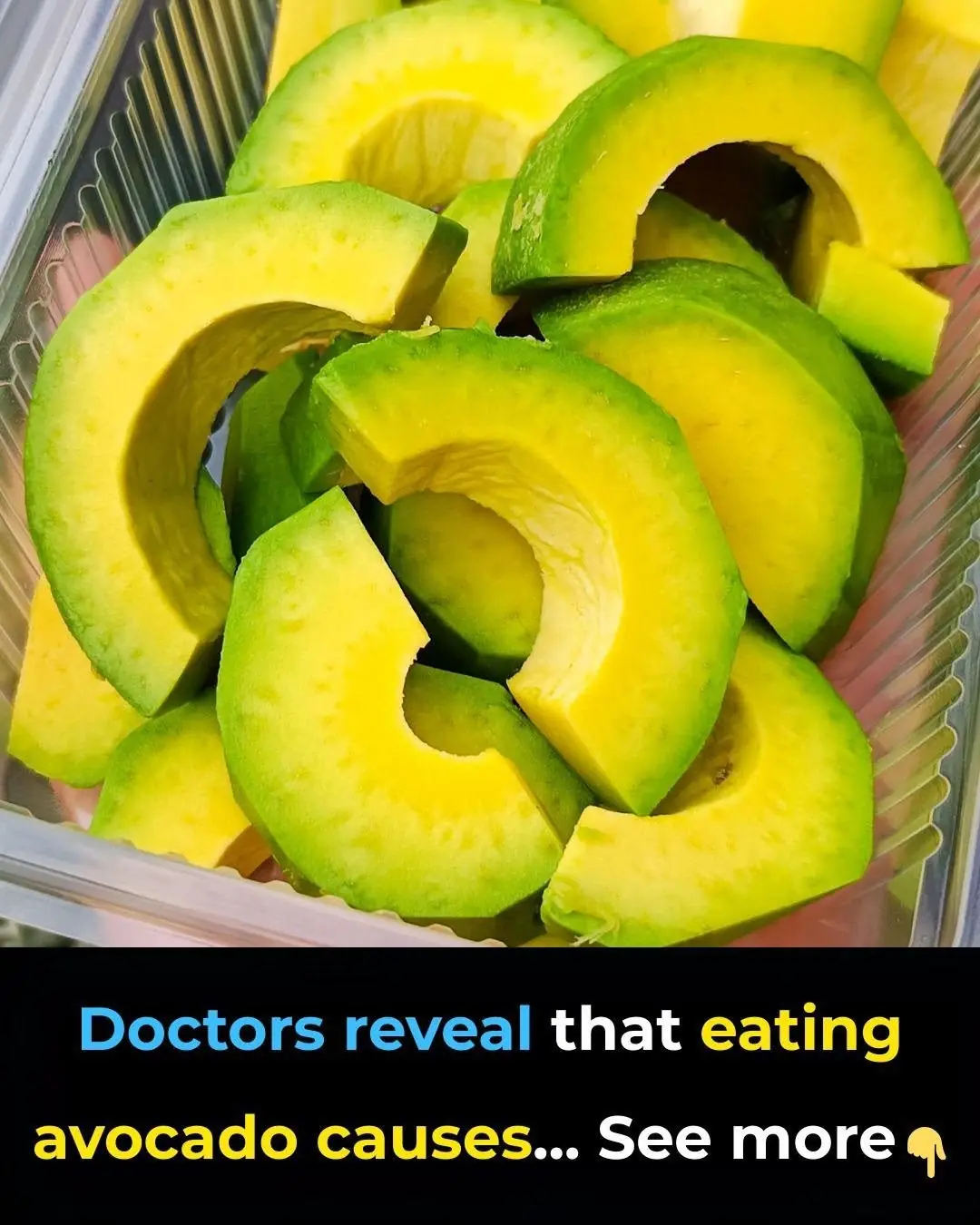 “Doctors Reveal Eating Avocado Causes…” — Let’s Clear the Clickbait