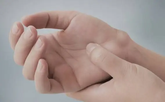 An Unexpected Lump May Have More to Do With Your Daily Routine Than You Realize