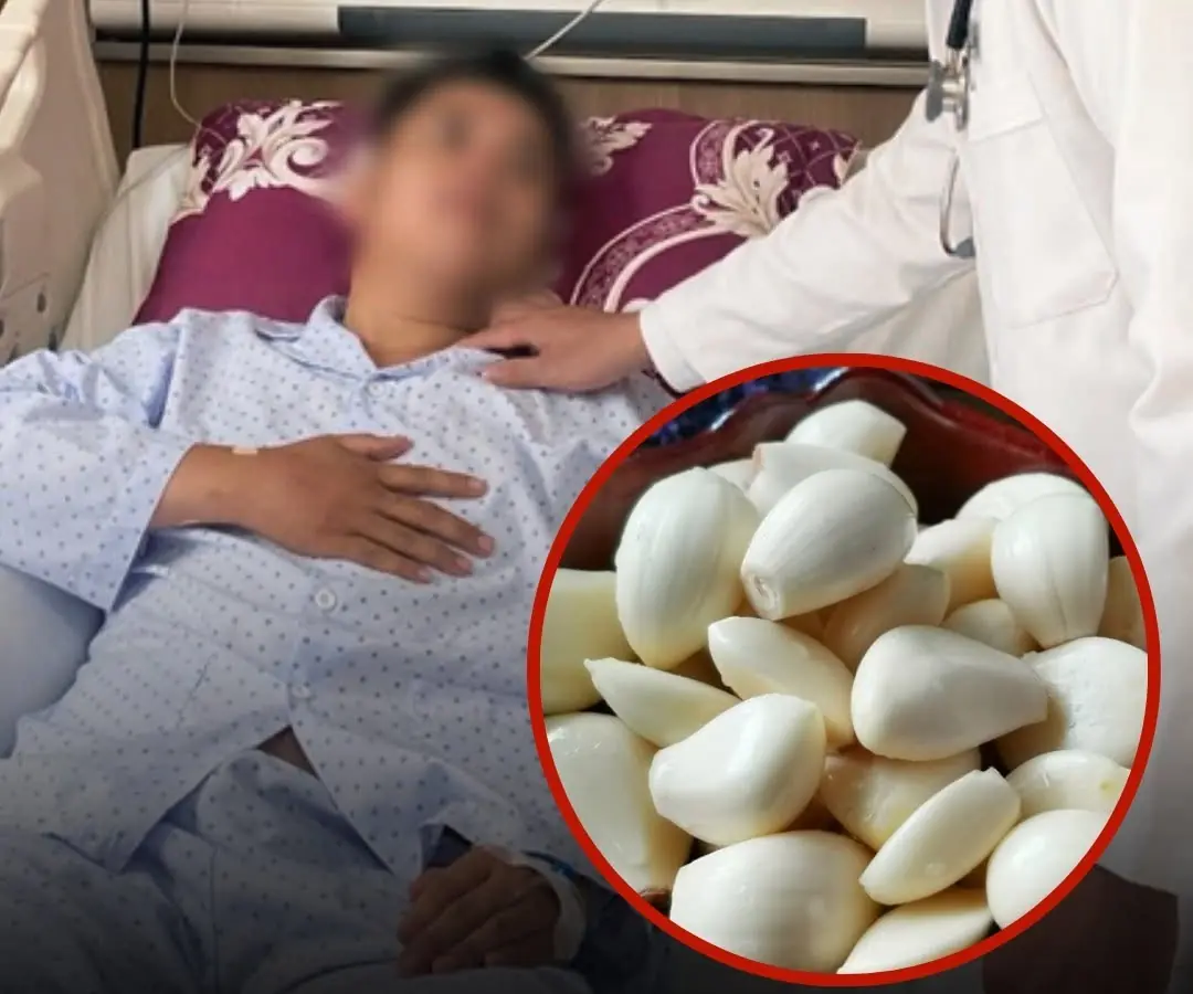 He Ate Garlic Every Day for 5 Months — What Happened to His Kidneys Surprised Doctors