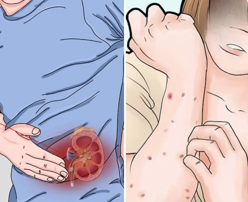 Your kidneys could be silently struggling