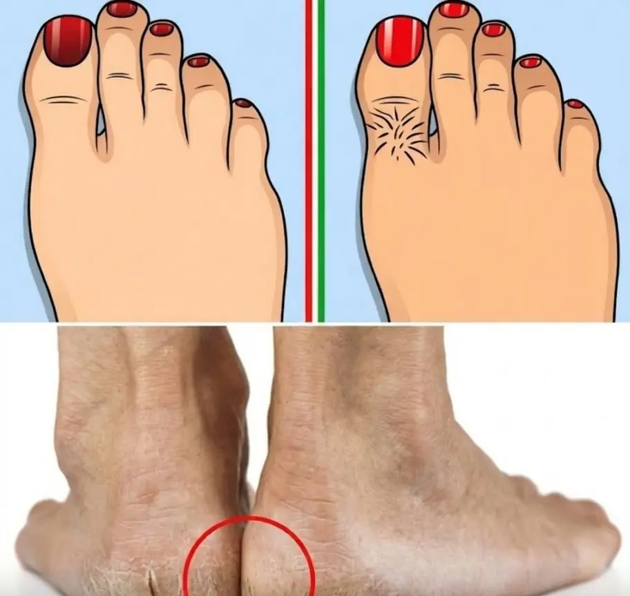 9 Signs in Your Feet That Could Reflect Your Overall Health
