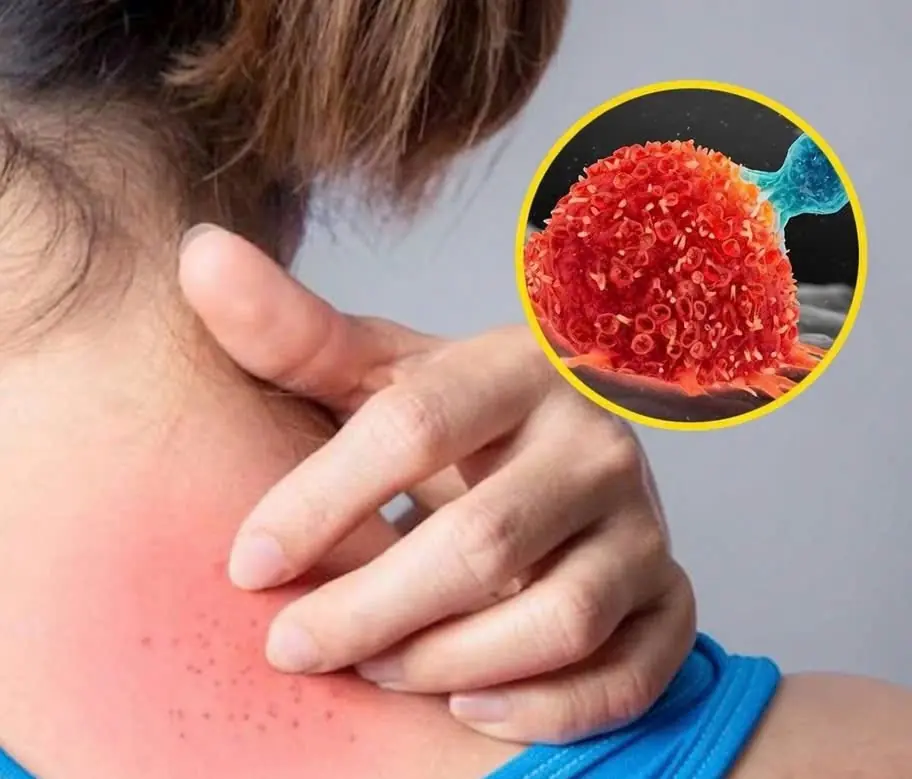 These 9 Unusual Itching Symptoms Could Be Your Body’s Way of Signaling Underlying Illness...