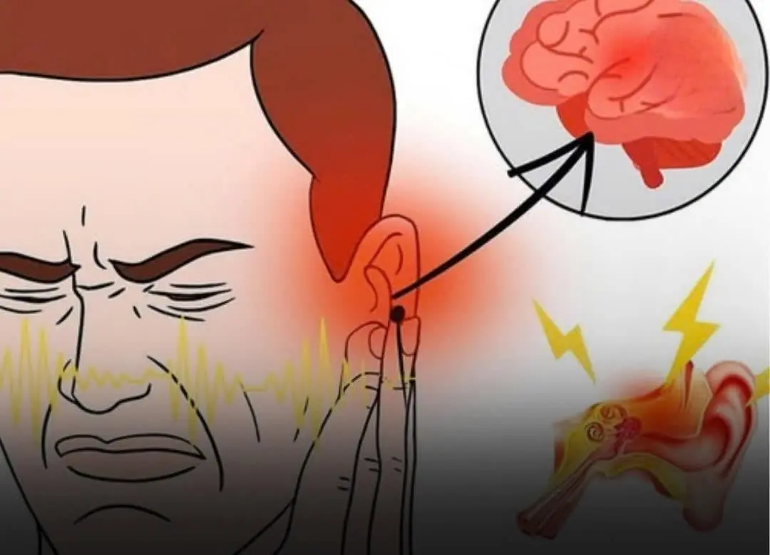 If you hear ringing in your ear, this is a sign that you will suffer from...