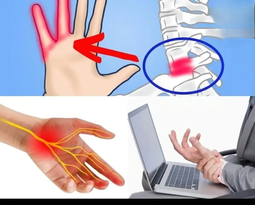 What Causes That Tingling Feeling in Your Hands?