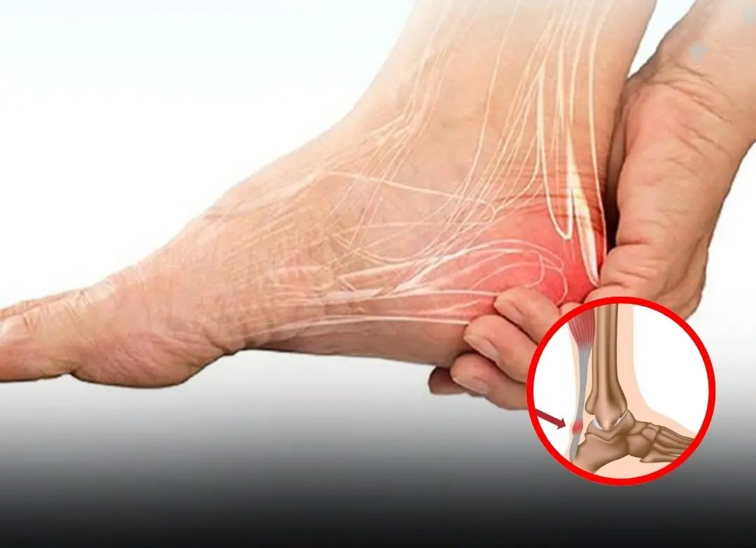 What Condition Causes Frequent Numbness in the Legs — and Why