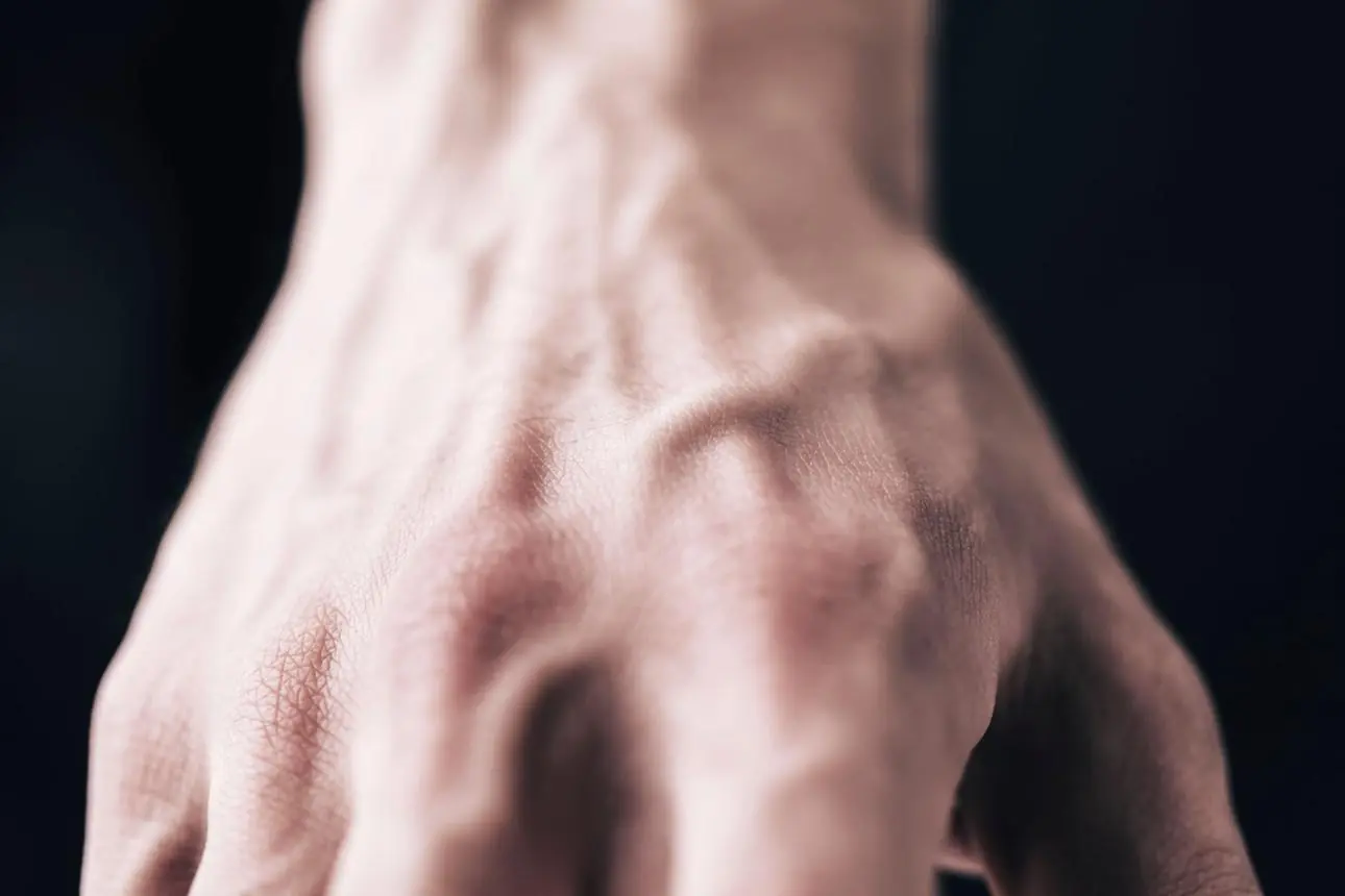 If Veins on Your Hands Are More Visible, What Could It Mean? Understanding the Possible Causes