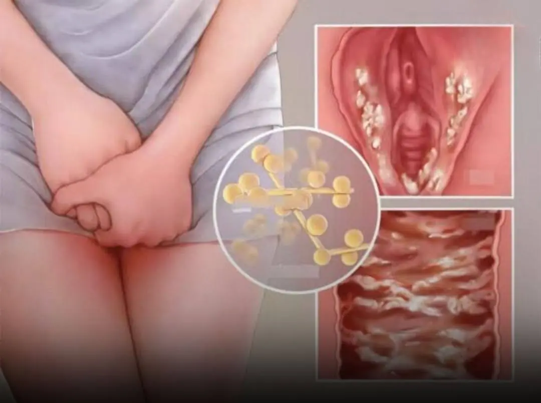Common habits that could lead to hidden infections