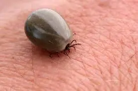 I Found a Strange Bug Hidden in My Son’s Hair… and Had No Idea What It Was!