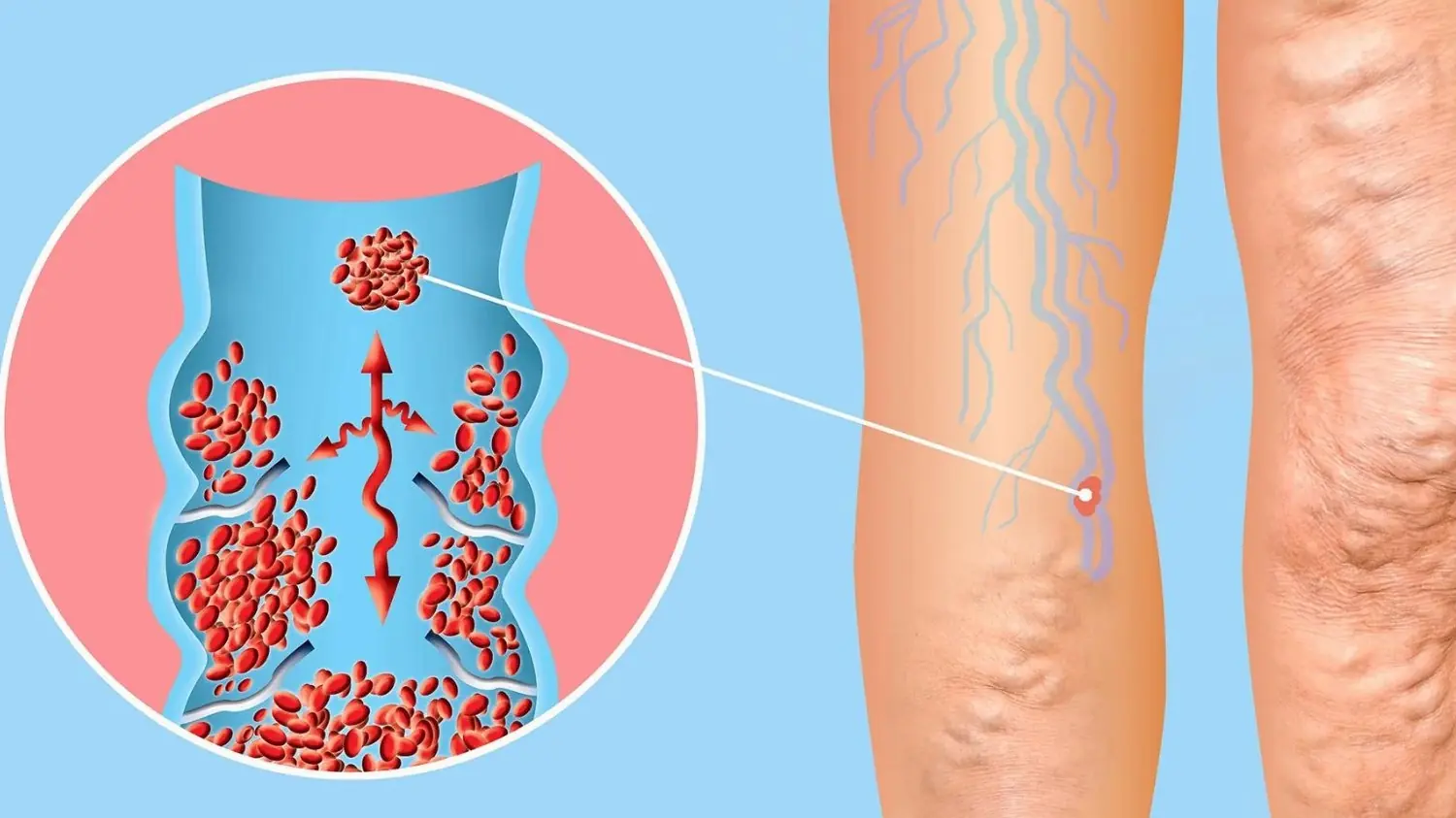 Cold Feet and Tired Legs Aren't Always Normal—6 Things You Can Do to Support Healthy Circulation