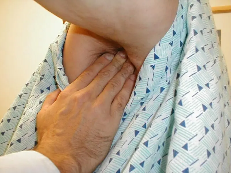 Swollen Lymph Nodes in the Armpit: A Health Warning You Shouldn’t Ignore