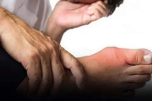Here are five unusual foot symptoms