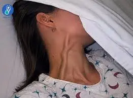 octors Explain What Bulging Neck Veins Could Mean for Your Heart and Circulation
