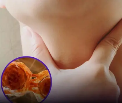Lym.phoma survivors share six symptoms they experienced before diagnosis 😨