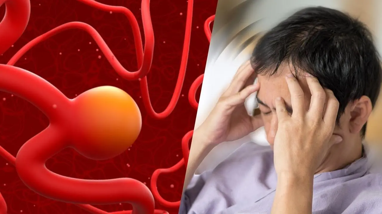 The Silent Danger of Aneurysms: Warning Signs Many People Miss