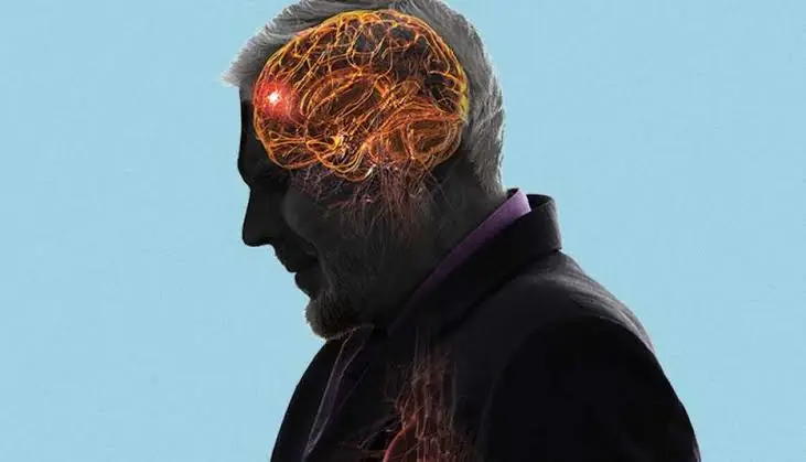 Mini Stroke Warning: 5 Symptoms That Require Immediate Attention