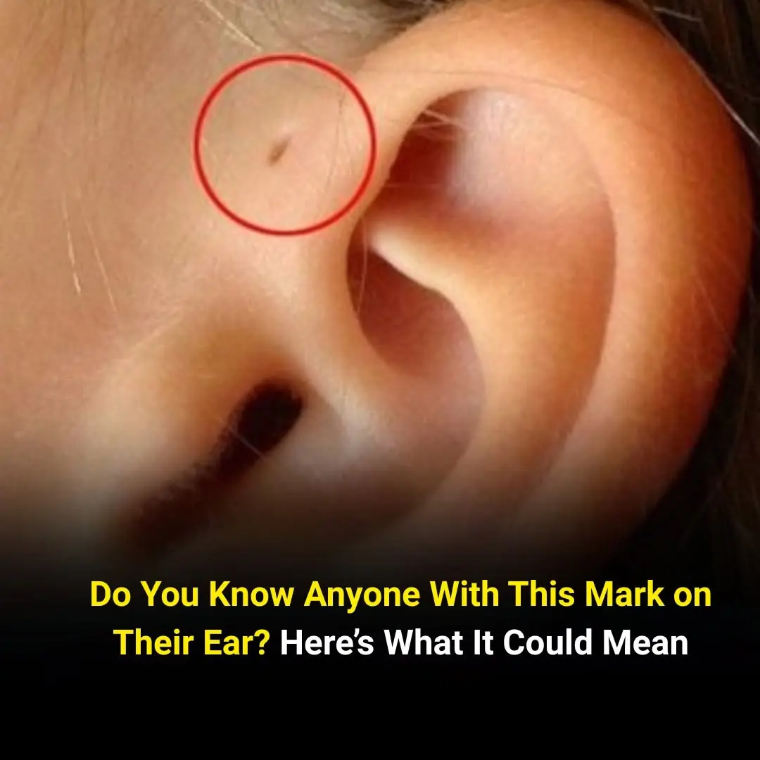 Here is what this little hole on the ear mean
