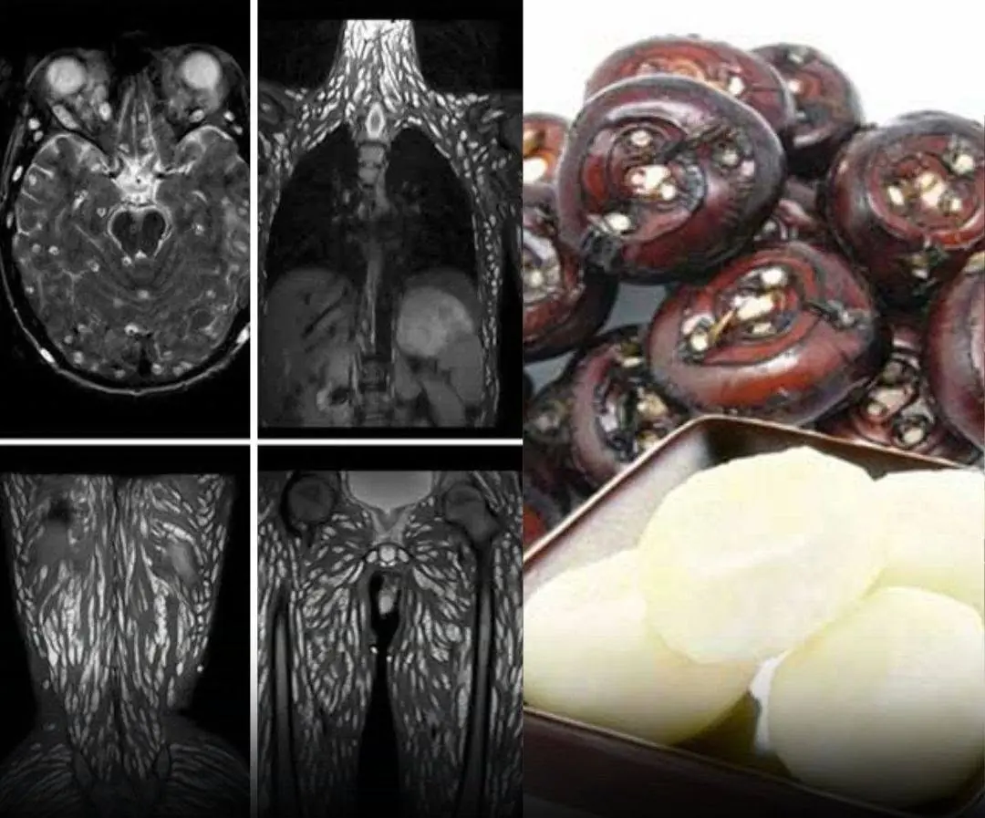 People often consume this food without knowing it could contain harmful parasites...