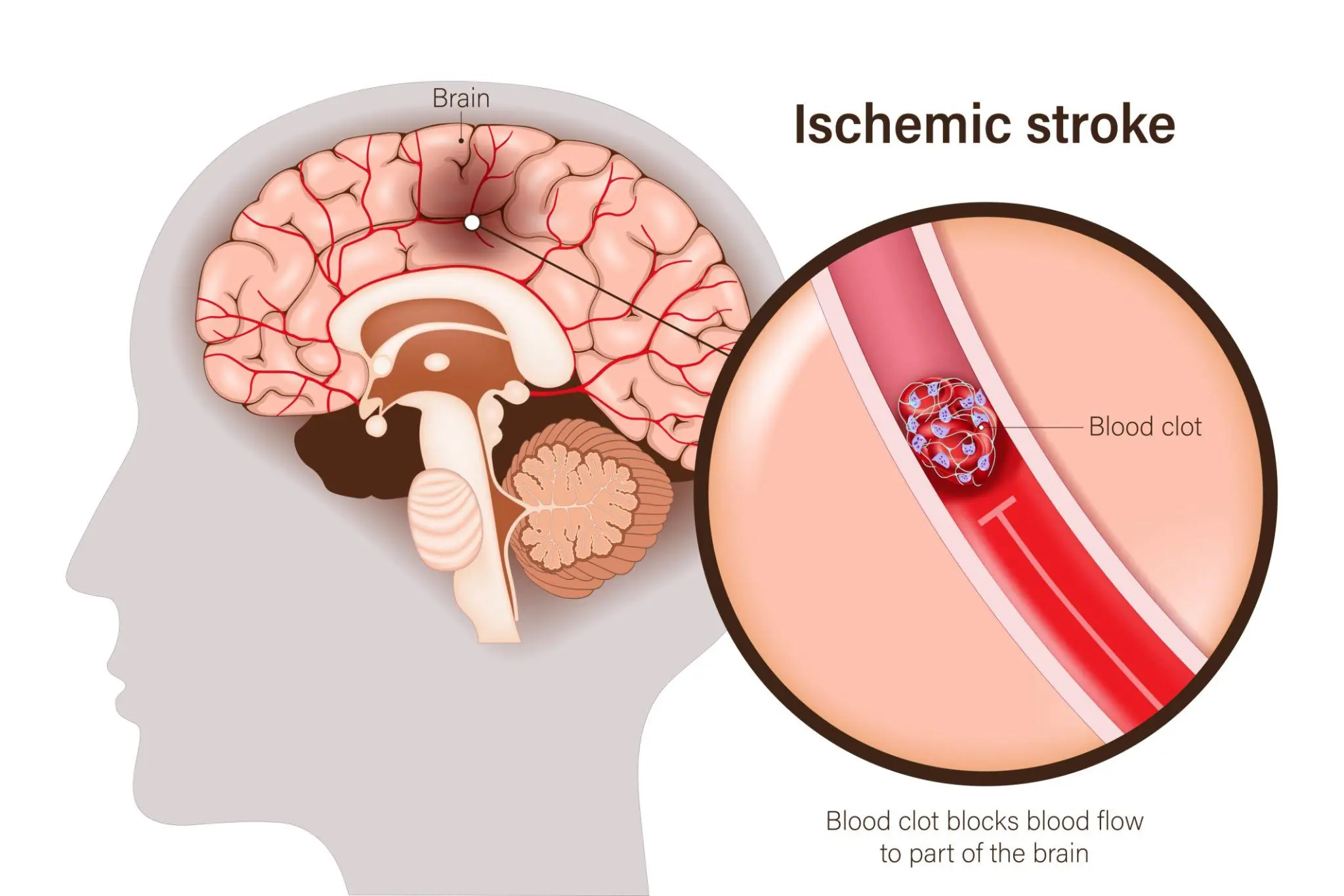 Man Has Stroke After Bathing Right After a Meal: 3 Common Mistakes You Should Never Make