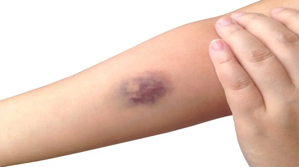 What You See on Your Skin and Body Could Reveal Important Health Clues