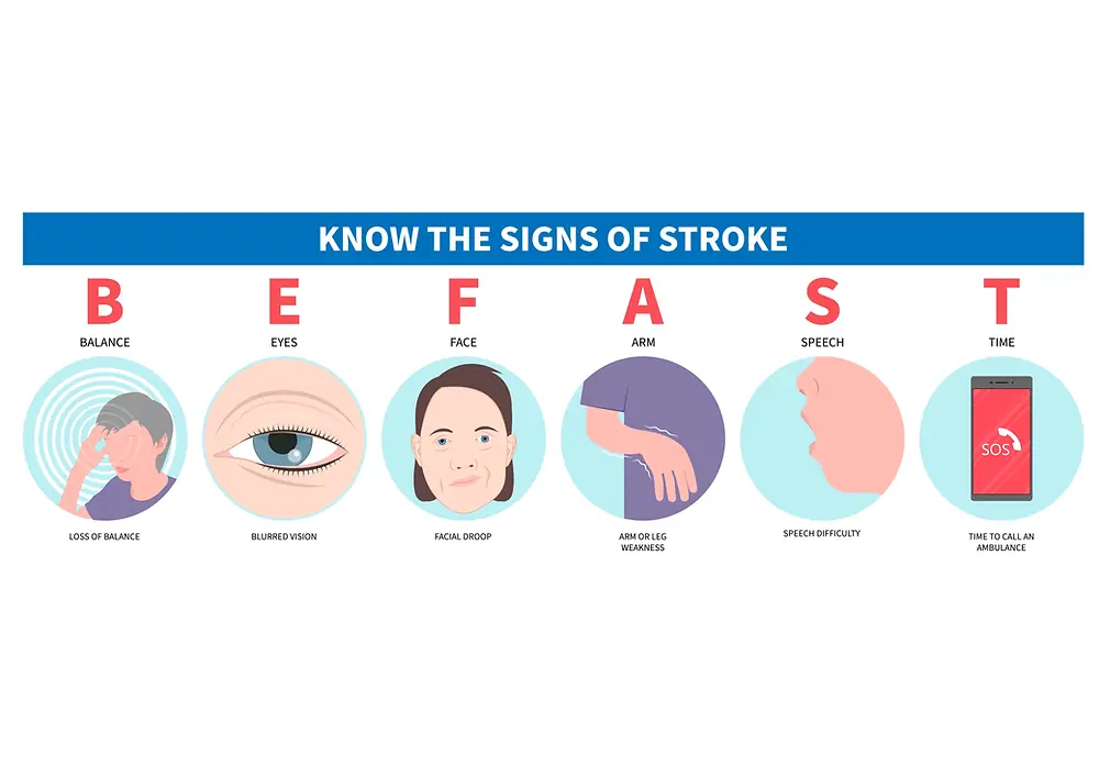 Your Body Might Be Giving You a One-Month Head Start: 10 Possible Stroke Symptoms
