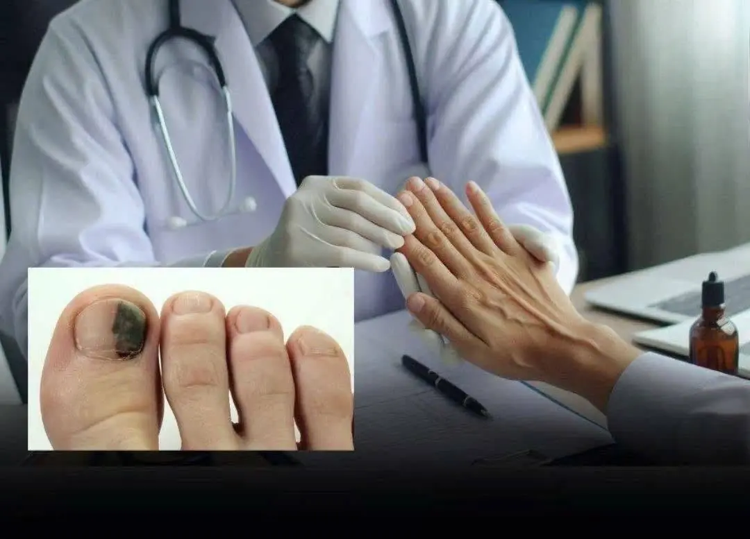 Early Warning Signs of Cancer May Sometimes Appear in the Arms or Legs