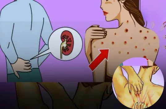 If your kidneys aren't working properly, the body shows these 10 signs
