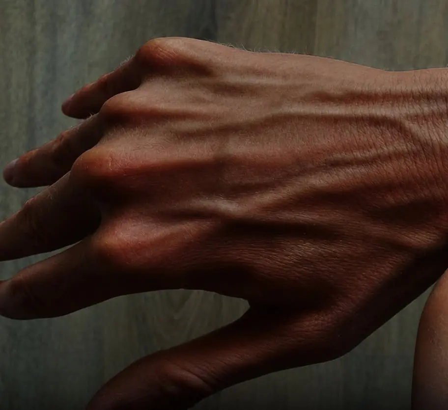Your veins may reveal more about your health than you think — especially if they suddenly change