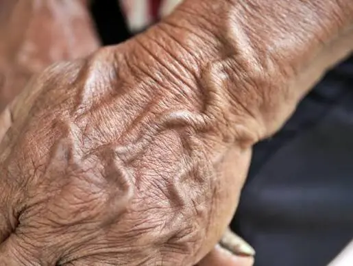 Seeing More Veins Than Usual? Here's What Experts Say It Could Mean