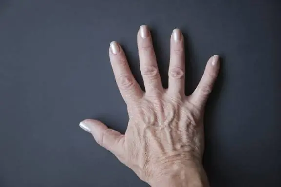 Have Noticeable Veins? Here's What Your Body Could Be Trying to Tell You