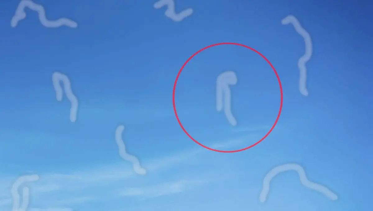 If Floaters Appear Out of Nowhere, Your Eyes May Be Telling You Something Important