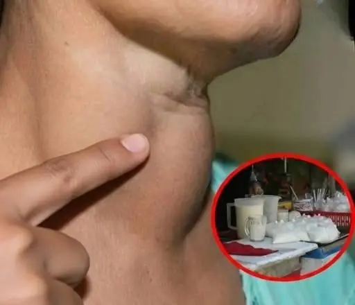 The rising number of thy.roid no.dules has doctors advising people to cut back on this particular food