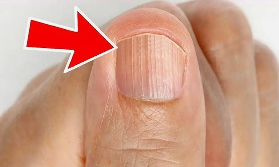 Nail Lines in Your 40s? Here's What They May Reveal About Your Health